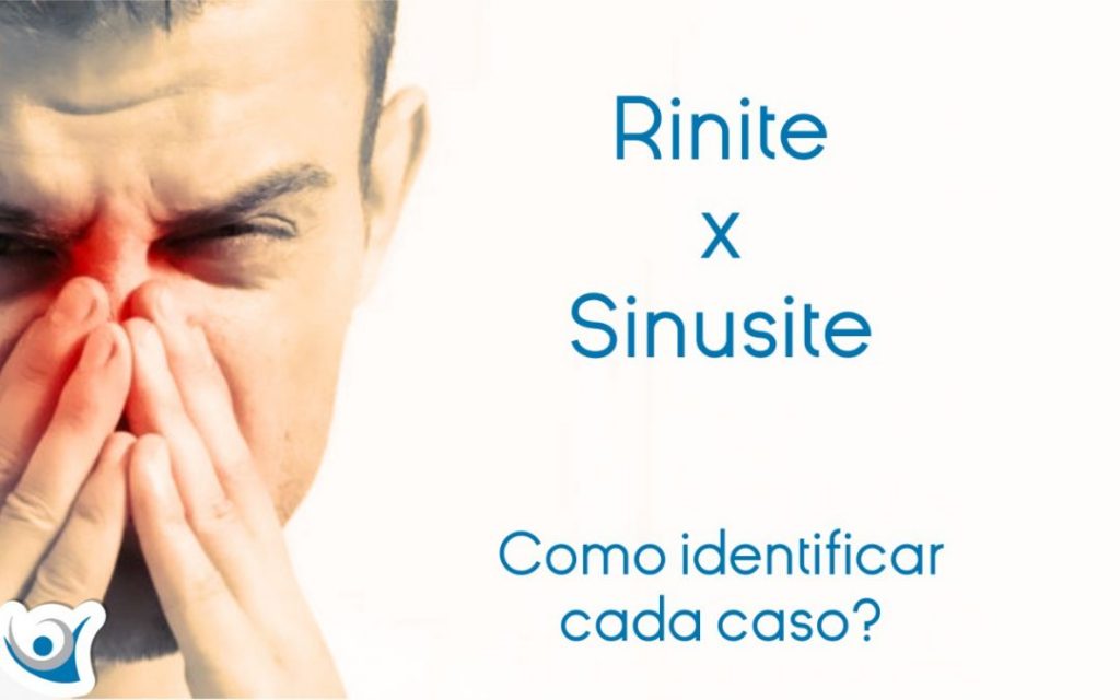 rinite sinusite site 1080x675 1